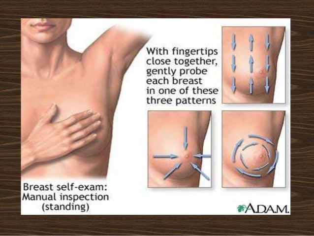 breast lump mast Breast lump mast